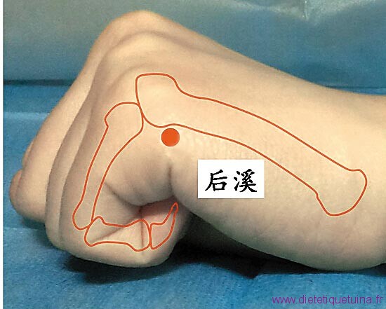 Le point Hou Xi du méridien de l’intestin grêle (3IG)