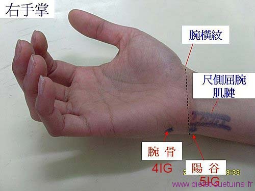 Le point Wan Gu du méridien de l’intestin grêle (4IG)